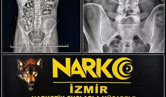 İzmir Havalimanı’nda yutulan 60 kapsülde uyuşturucu bulundu